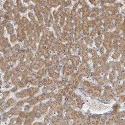 Immunohistochemistry-Paraffin: Fumarase Antibody [NBP1-89815]