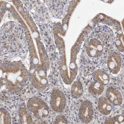 Immunohistochemistry-Paraffin: Fumarase Antibody [NBP1-89815]