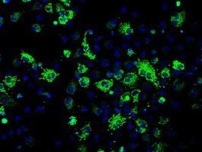 Immunocytochemistry/ Immunofluorescence: Fumarase Antibody (OTI1F10) - Azide and BSA Free [NBP2-70733]