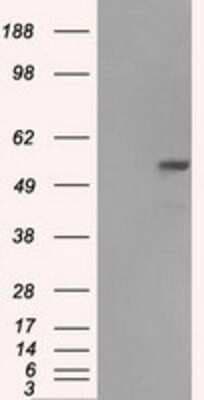 Western Blot: Fumarase Antibody (OTI1F10)Azide and BSA Free [NBP2-70733]