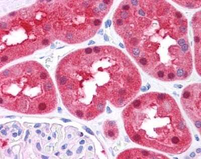 Immunohistochemistry-Paraffin: Fumarylacetoacetate hydrolase Antibody [NBP1-53110]