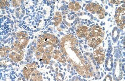 Immunohistochemistry-Paraffin: Fumarylacetoacetate hydrolase Antibody [NBP1-53110]