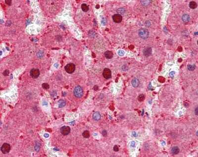 Immunohistochemistry-Paraffin: Fumarylacetoacetate hydrolase Antibody [NBP1-53110]