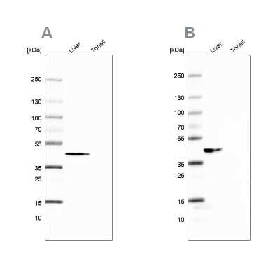 Western Blot: Fumarylacetoacetate hydrolase Antibody [NBP2-48736]