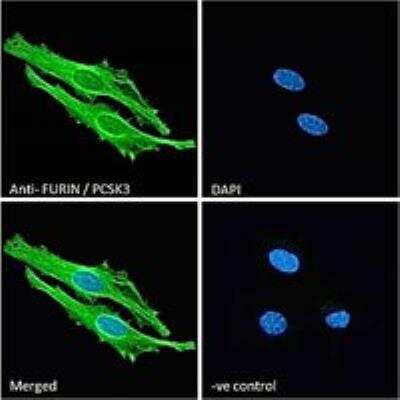 Immunocytochemistry/ Immunofluorescence: Furin Antibody [NBP2-26104]