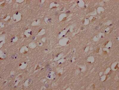 Immunohistochemistry: Fyn Antibody (1G3) [NBP3-15159]