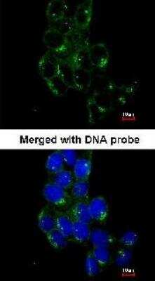 Immunocytochemistry/ Immunofluorescence: Fyn Antibody [NBP1-32067]