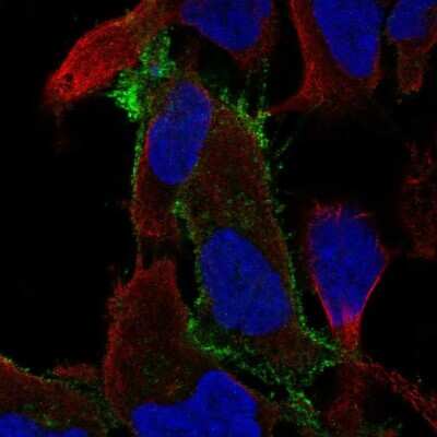 Immunocytochemistry/ Immunofluorescence: Fyn Antibody [NBP1-82685]