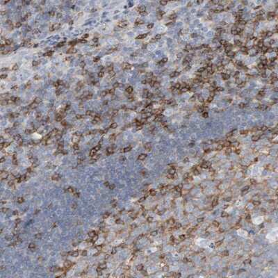 Immunohistochemistry-Paraffin: Fyn Antibody [NBP1-82685]