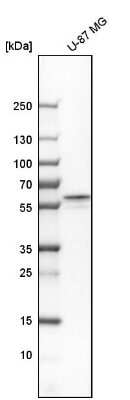 Western Blot: Fyn Antibody [NBP1-82685]