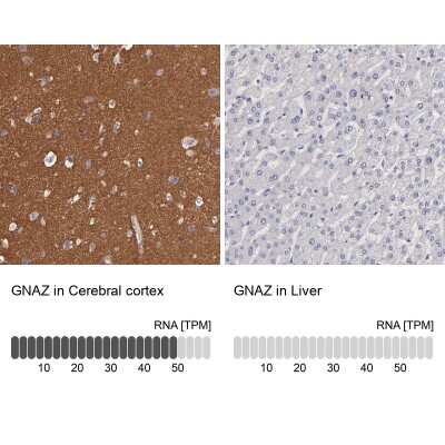 Immunohistochemistry-Paraffin: G Protein alpha z Antibody [NBP1-88111]
