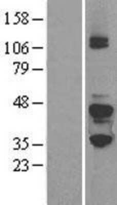 Western Blot: G Protein alpha z Overexpression Lysate [NBL1-11163]