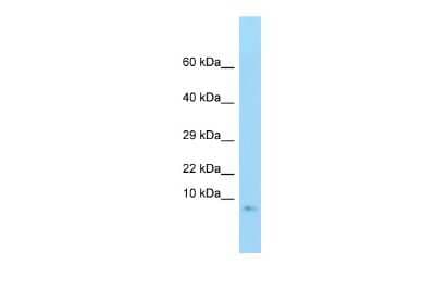 Western Blot: G gamma3 Antibody [NBP2-84034]