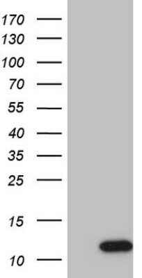 Western Blot: G gamma7 Antibody (OTI3G1) [NBP2-45911]
