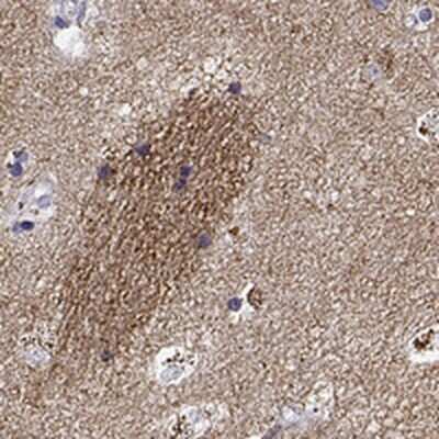 Immunohistochemistry-Paraffin: G gamma7 Antibody [NBP2-46845]