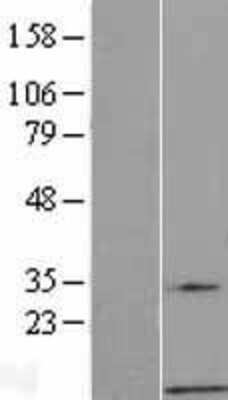 Western Blot: G gamma7 Overexpression Lysate [NBL1-11177]
