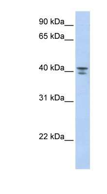 Western Blot: G protein alpha 12 Antibody [NBP1-55321]