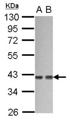 Western Blot: G protein alpha 12 Antibody [NBP2-16556]