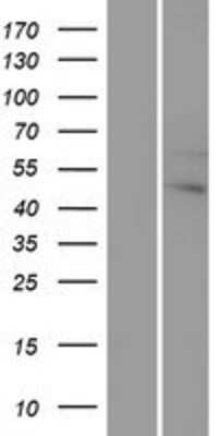 Western Blot: G protein alpha 12 Overexpression Lysate [NBP2-10367]