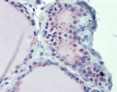 Immunohistochemistry: G protein alpha Antibody [NBP1-58349]