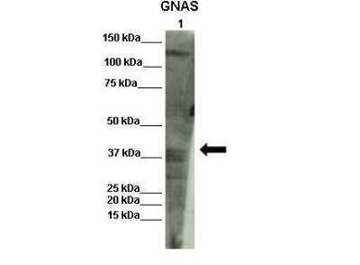 Immunohistochemistry: G protein alpha Antibody [NBP1-58349]