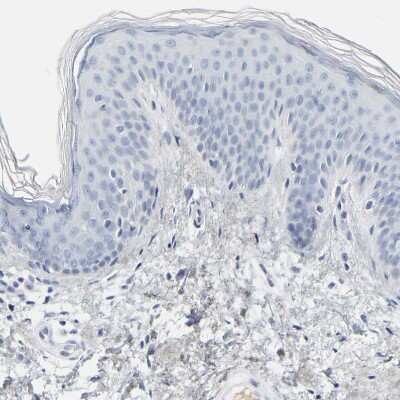Immunohistochemistry-Paraffin: G protein alpha Antibody [NBP1-89754]