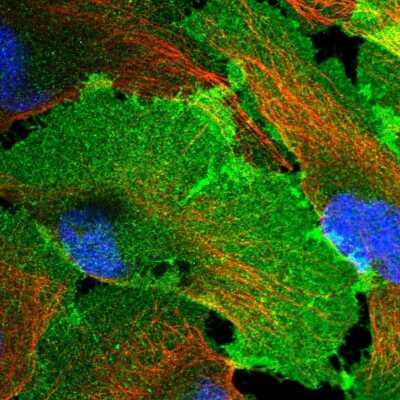 Immunocytochemistry/ Immunofluorescence: G protein beta 4 Antibody [NBP2-14060]