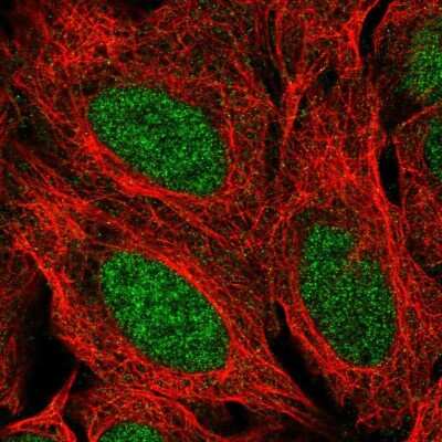 Immunocytochemistry/ Immunofluorescence: G-substrate Antibody [NBP2-13800]