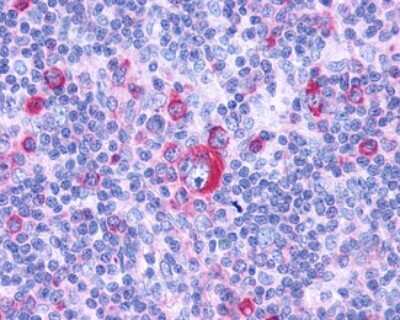 Immunohistochemistry-Paraffin: G2A/GPR132 Antibody - BSA Free [NLS1600]