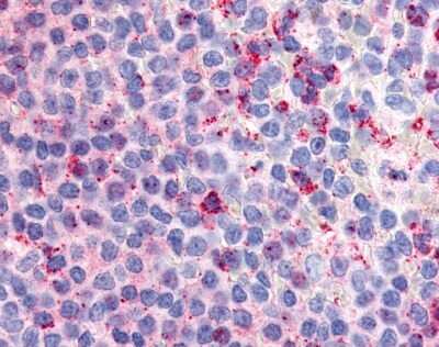Immunohistochemistry-Paraffin: G2A/GPR132 Antibody - BSA Free [NLS3702]