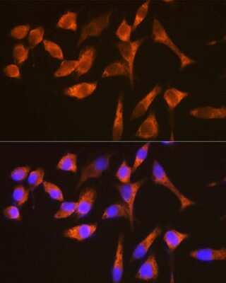 Immunocytochemistry/ Immunofluorescence: G3BP1 Antibody (5A4T0) [NBP3-16302]