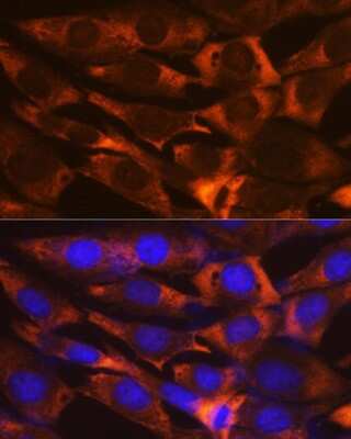 Immunocytochemistry/ Immunofluorescence: G3BP1 Antibody (5A4T0) [NBP3-16302]