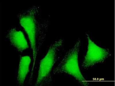 Immunocytochemistry/ Immunofluorescence: G3BP1 Antibody [H00010146-B01P]
