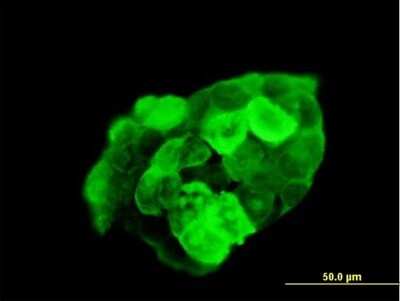 Immunocytochemistry/ Immunofluorescence: G3BP1 Antibody [H00010146-B01P]