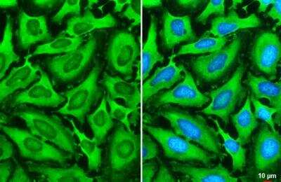 Immunocytochemistry/ Immunofluorescence: G3BP1 Antibody [NBP2-16563]