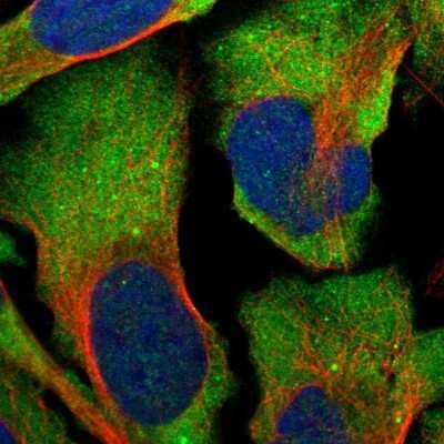 Immunocytochemistry/ Immunofluorescence: G3BP2 Antibody [NBP1-82977]