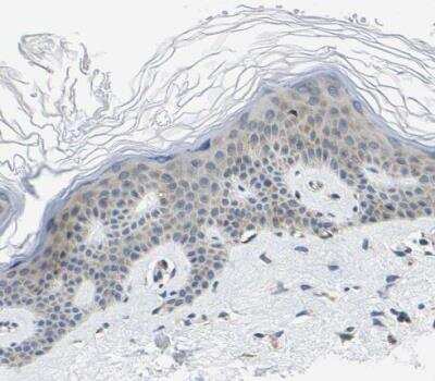 Immunohistochemistry-Paraffin: G3BP2 Antibody [NBP1-82976]
