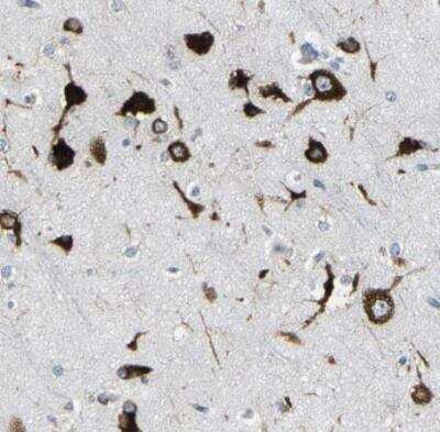 Immunohistochemistry-Paraffin: G3BP2 Antibody [NBP1-82976]