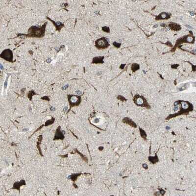 Immunohistochemistry-Paraffin: G3BP2 Antibody [NBP1-82977]