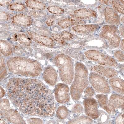 Immunohistochemistry-Paraffin: G6PC Antibody (CL5817) [NBP2-61432]