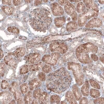 Immunohistochemistry-Paraffin: G6PC Antibody (CL5818) [NBP2-61433]