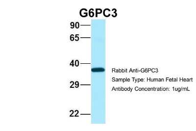 Western Blot: G6PC3 Antibody [NBP2-82857]