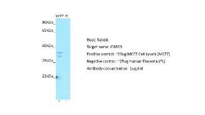 Western Blot: G6PC3 Antibody [NBP2-82857]