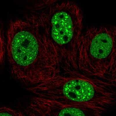Immunocytochemistry/ Immunofluorescence: G9a/EHMT2 Antibody [NBP2-55881]
