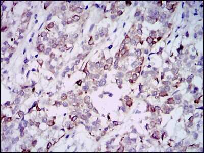 Immunohistochemistry-Paraffin: GAB1 Antibody (1A7) - BSA Free [NBP2-37742]