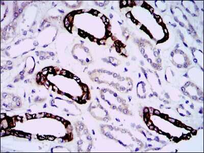 Immunohistochemistry-Paraffin: GAB1 Antibody (1A7) - BSA Free [NBP2-37742]