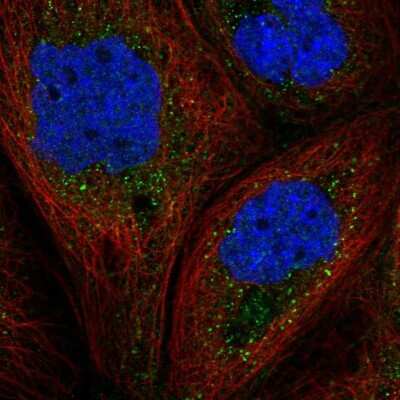 Immunocytochemistry/ Immunofluorescence: GAB1 Antibody [NBP3-05522]