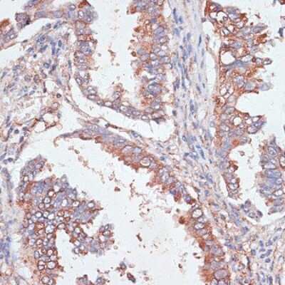 Immunohistochemistry-Paraffin: GAB1 Antibody - Azide and BSA Free [NBP3-04453]