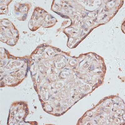 Immunohistochemistry-Paraffin: GAB1 Antibody - Azide and BSA Free [NBP3-04453]