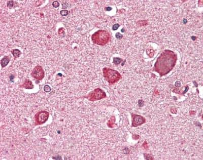 Immunohistochemistry-Paraffin: GABA-AR alpha 6 Antibody [NBP2-26069]